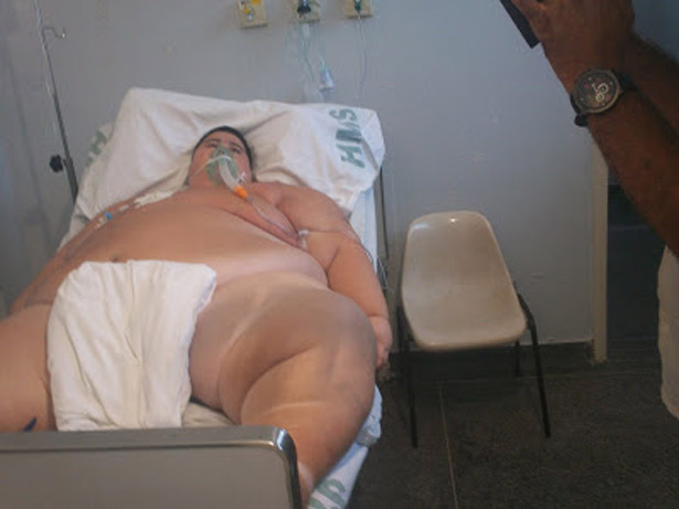 Jovem que pesa 260 kg recebe alta médica