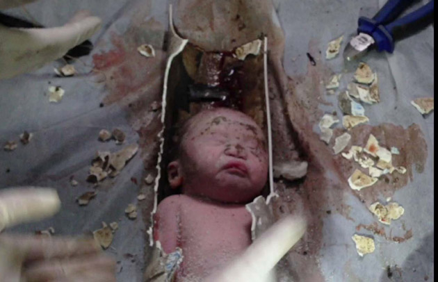 Inacreditável: Recém-nascido é resgatado de cano de esgoto na China. Veja fotos