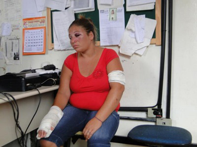Jaguaquara: Mulher é esfaqueada durante assalto dentro de casa