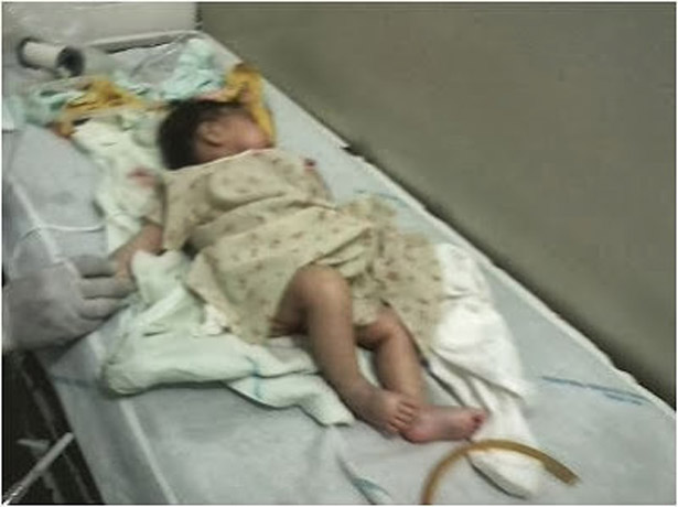Iguaí: bebê com sinais de maus tratos morre em hospital