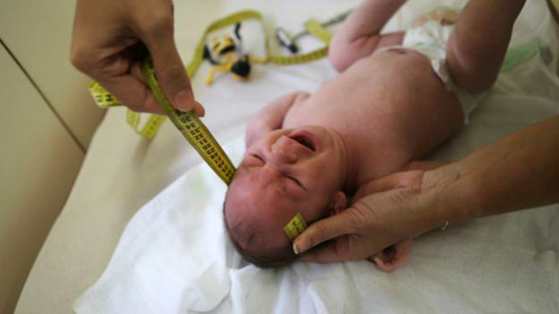 Maioria dos brasileiros desaprova aborto mesmo com microcefalia