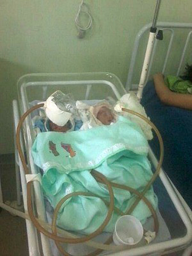 Hospital improvisa garrafa no lugar de máscara de oxigênio e bebê morre