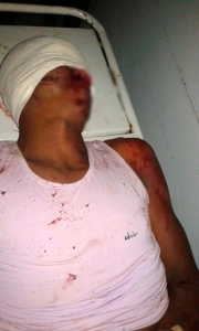 Marau: Acidente na BR 030 deixa uma vítima fatal e outro gravemente ferido