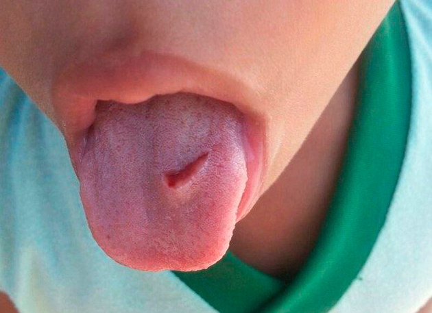 Mãe diz que professora cortou língua de criança como castigo em creche na Bahia