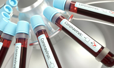 Ipiaú: Mais três pacientes testam positivo para covid-19