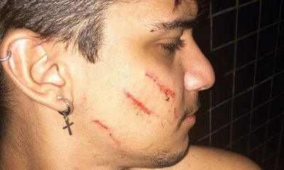 Jovem divulga agressão nas redes sociais e afirma que foi vítima de ataque homofóbico por vizinha na BA: 'Muito injusto'